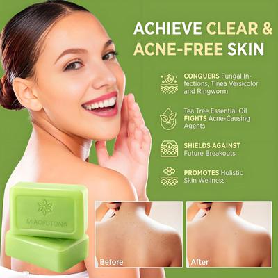 Relief Soap Bar Tea Tree Oil Soap Deep Cleansing Face Body Bar for Oil Control Moisturizing 115g Handmade Natural Body Soap for All Skin Types