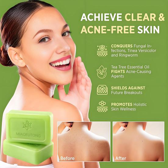 Relief Soap Bar Tea Tree Oil Soap Deep Cleansing Face Body Bar for Oil Control Moisturizing 115g Handmade Natural Body Soap for All Skin Types