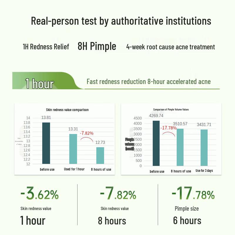 

Ma Ying Long Babao Purifying Acne Cream