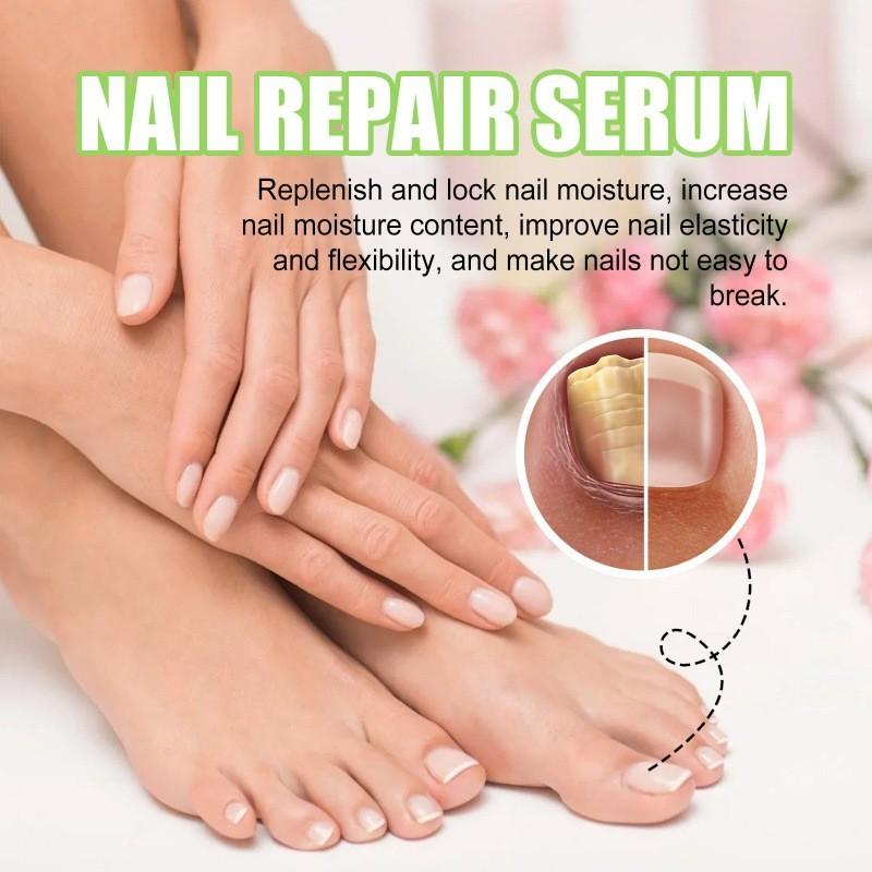 Nourishing And Revitalizing Ximonth Nail Repair Essence For Healthy Strong Nails