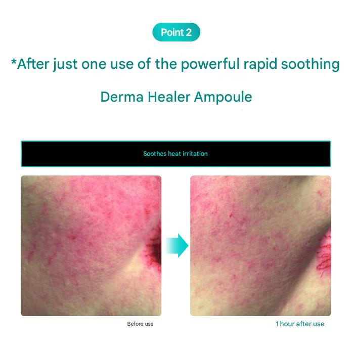 Rejuran Ampułka nawilżająca Derma Healer 30ml  (3 opcje)