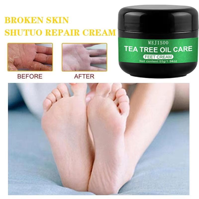 Herbal Anti Crack Foot Cream Heel Cracking Repair Products Exfoliation Dead Skin Removal Softening Moisturize Smooth Skin Care