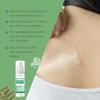 Refreshing Ximonth Salicylic Acid Herbal Body Spray For Moisturizing Hydration Bliss