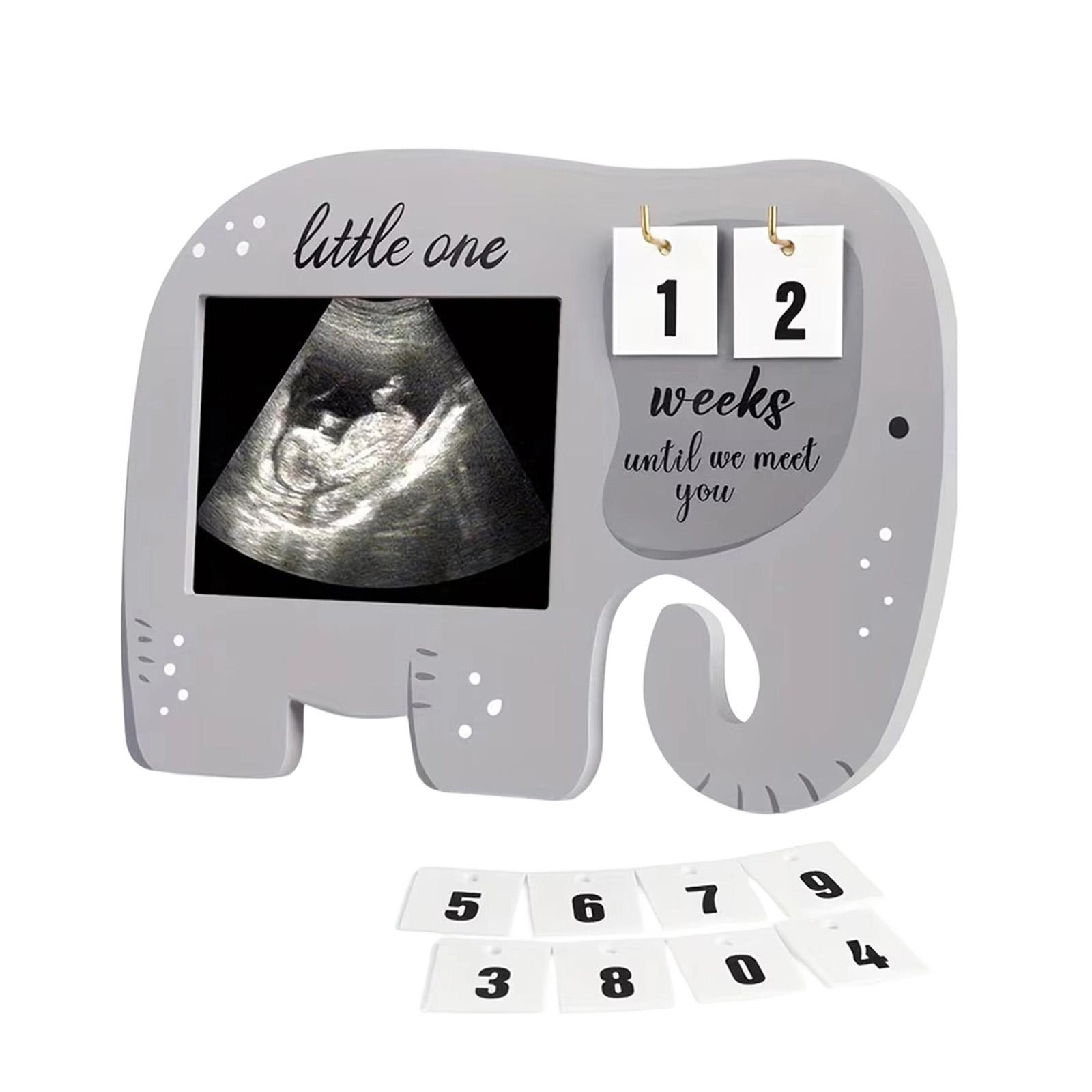 

Sonogram Picture Frame Ultrasound Photo Display With Baby Countdown Weeks Pregnancy Announcement Baby Gender Reveal Gift New Mom Parents One Size
