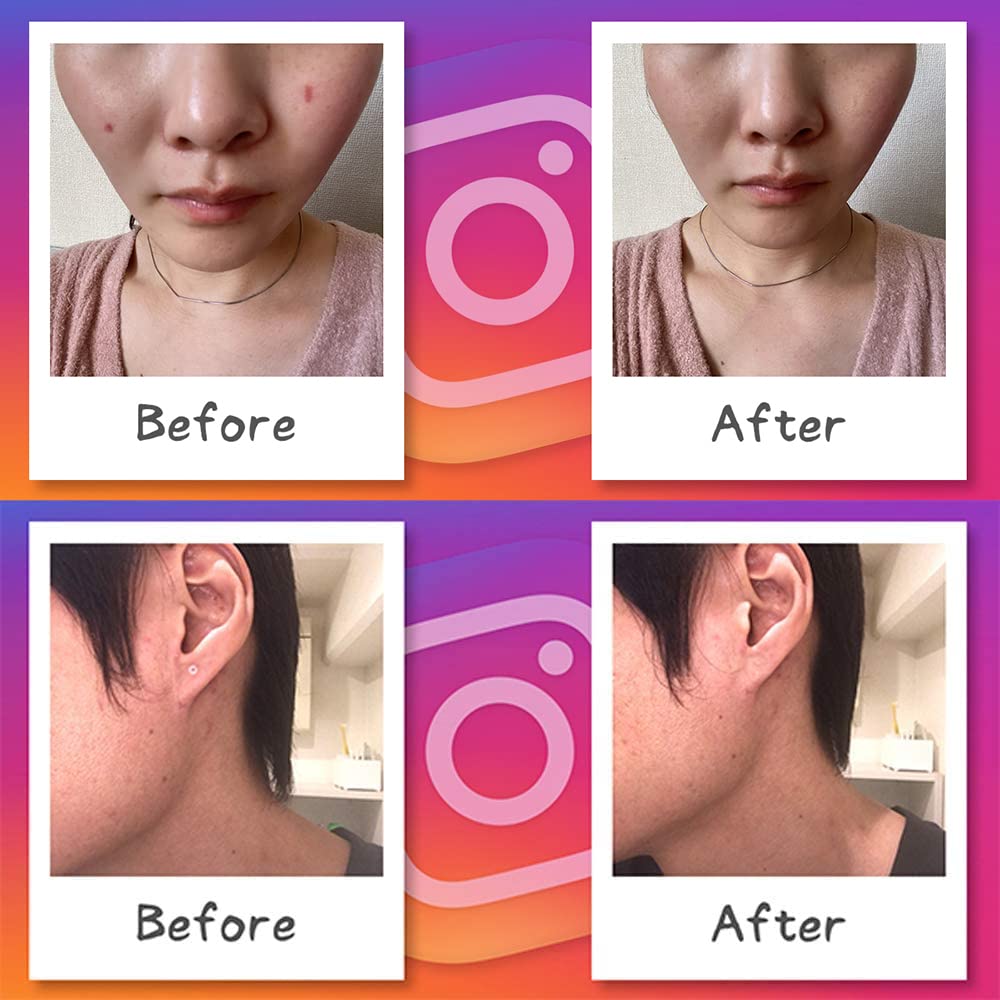 Foundation Tape Piercing Mole Same 5 Sheets For Face and Ears (Clear Concealer, Concealer), Round, Color, (30 Sheets), (Pink Ochre)