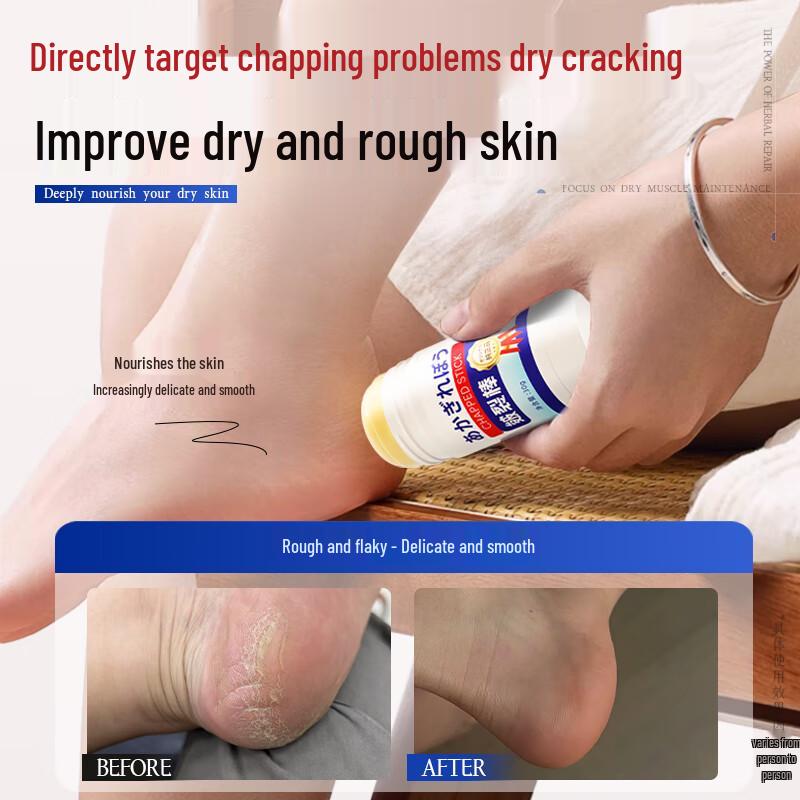 Taichuan Horse Oil Anti-Cracking Hand & Foot Balm Stick