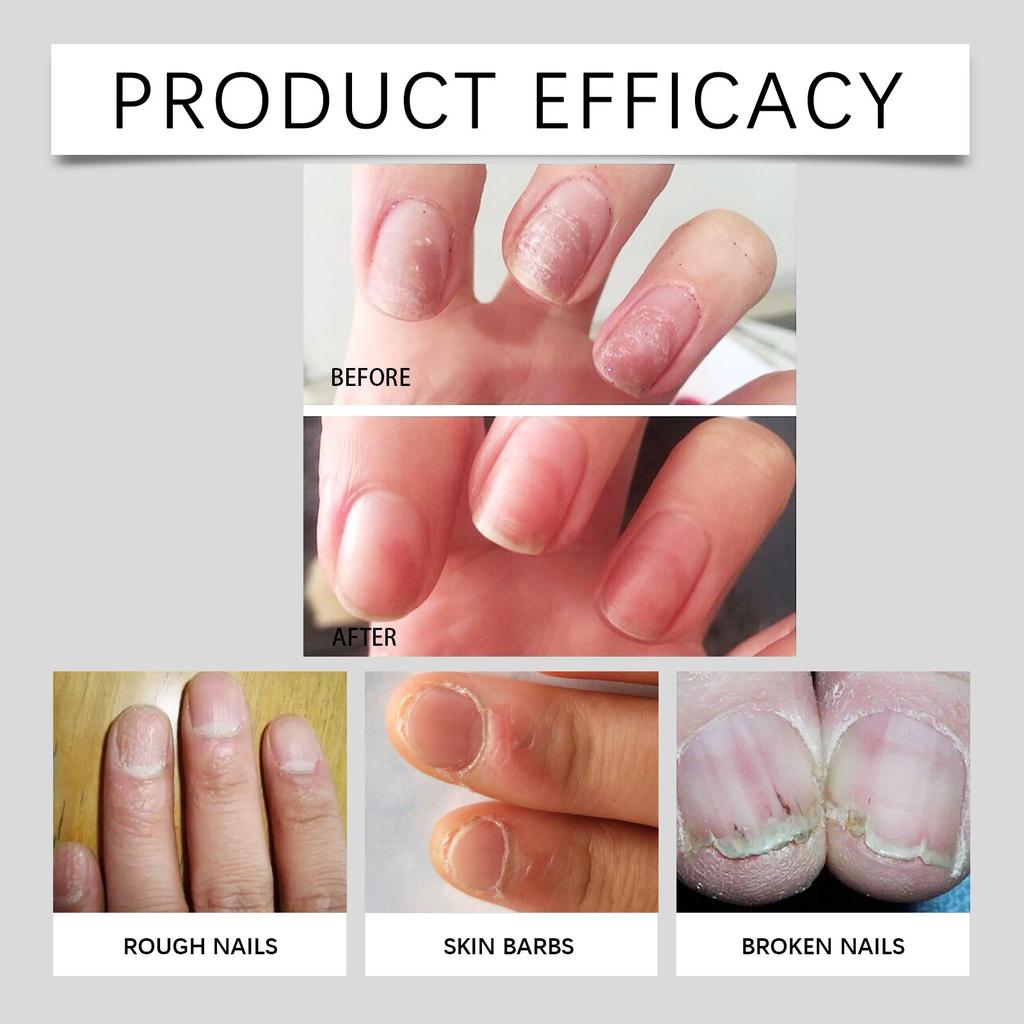 Liquid Soft Nail Thickening  Cream Nail Polish Special Ingrown Nail Granulation Care 3ML