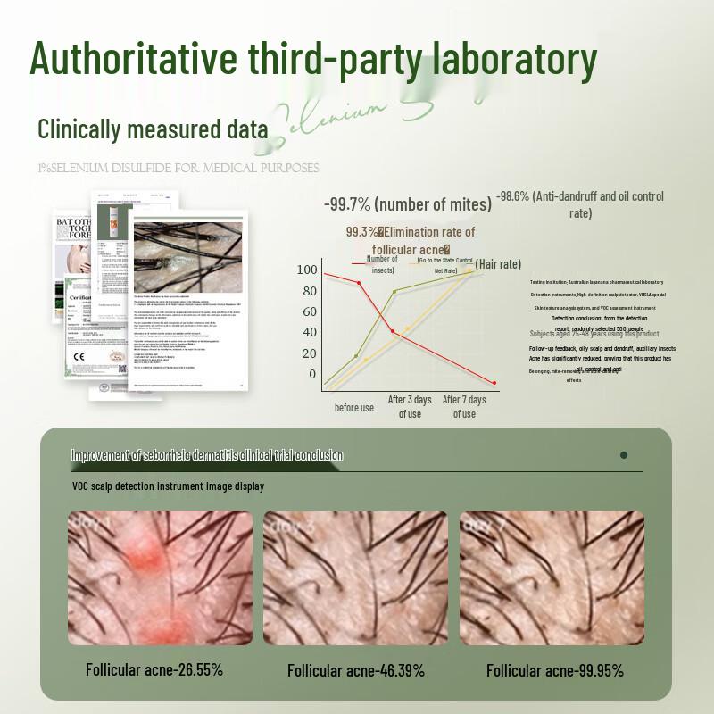 Layanana 1% Selenium Disulfide Anti-Dandruff Shampoo