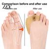 Hallux Valgus Corrector 1 Pair Toe Separator for Overlapping Toes, Soft SEBS Bunion Corrector, Double Breathable Hole Foot Spacer Valgus, Straightener