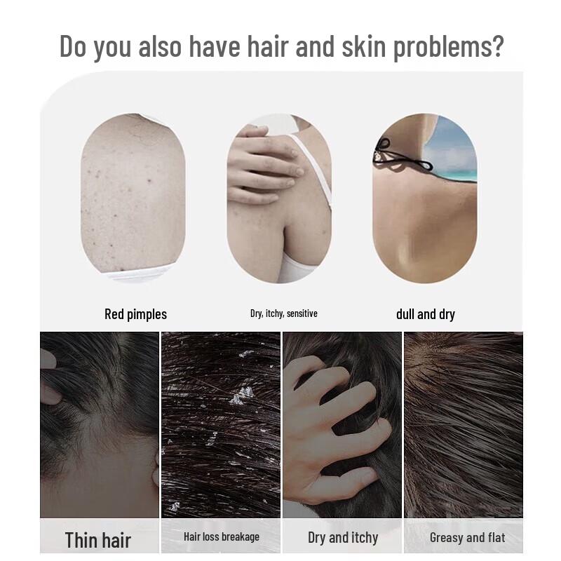 Shilang Anti-Hair Loss Shampoo & Green Tea Shower Gel Set