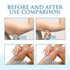Ouhoe Moisturizing Cooling Cream For Deep Hydration And Soothing Relief From Sunburn And Dry Skin In 200g Packaging