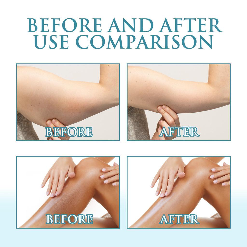 Ouhoe Moisturizing Cooling Cream For Deep Hydration And Soothing Relief From Sunburn And Dry Skin In 200g Packaging