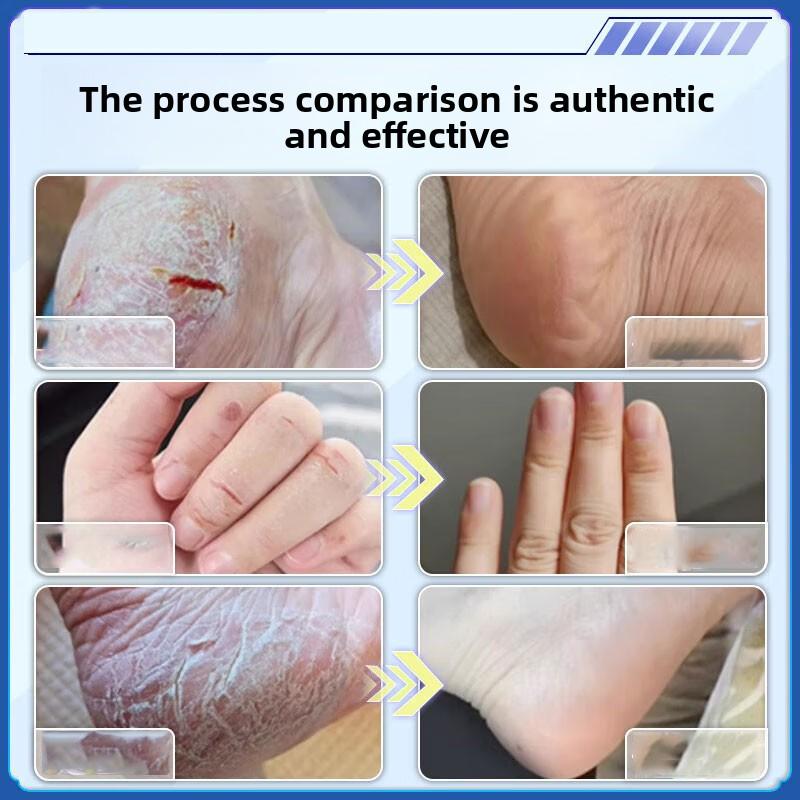 Organic Herbal Cream - Repair & Nourish Dry Cracked Hands & Feet