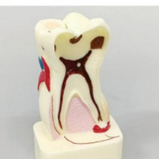 PH4015 Dental Pathology Analysis: Model 4x for Comprehensive Oral Disease Teaching