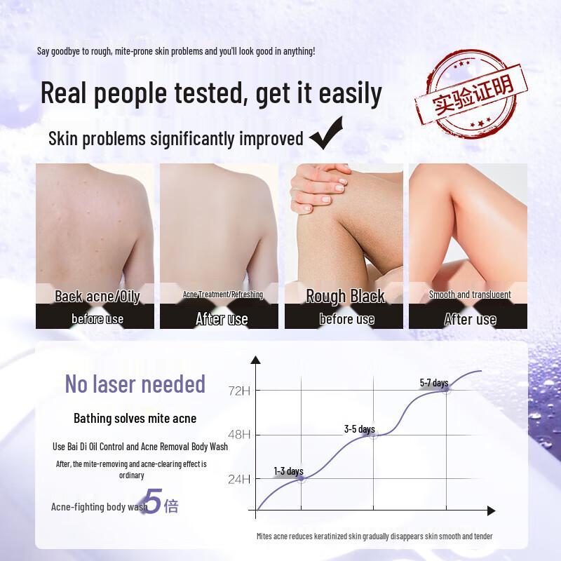 Baitime Oil Control & Acne Removal Shower Gel