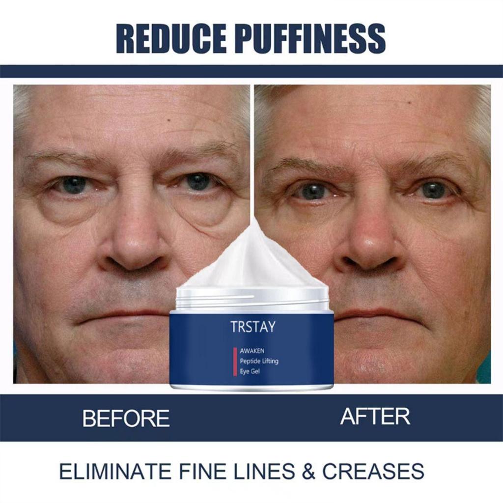 Face Cream Lifting Anti Aging Anti Eye Bags Moisturizer Facial Treatment