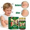 Gentle Infant Mosquito Bite Care: Thai Dingding Ointment (0-3 Years) for Bite Swelling