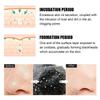 10/20/50/100PCS Unisex Nasal Strips Blackhead Remover Mask Acne Pimples Treatment Patch Shrink Pores Nose Stickers Skin Care
