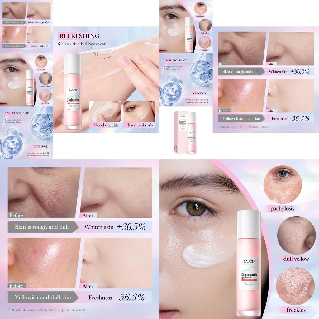 Sadoer Niacinamid Hautaufhellende Reparatur-Lotion für strahlende Haut und Fleckenbehandlung