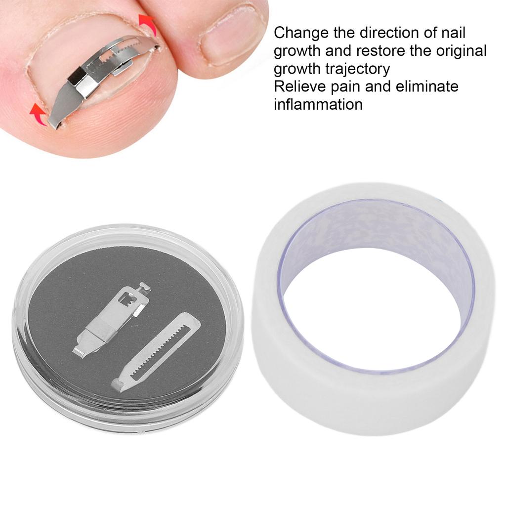 Ingrown Toenail Corrector Stainless Steel Paronychia Correction Tool with Adhesive Tape for Toenail Correction