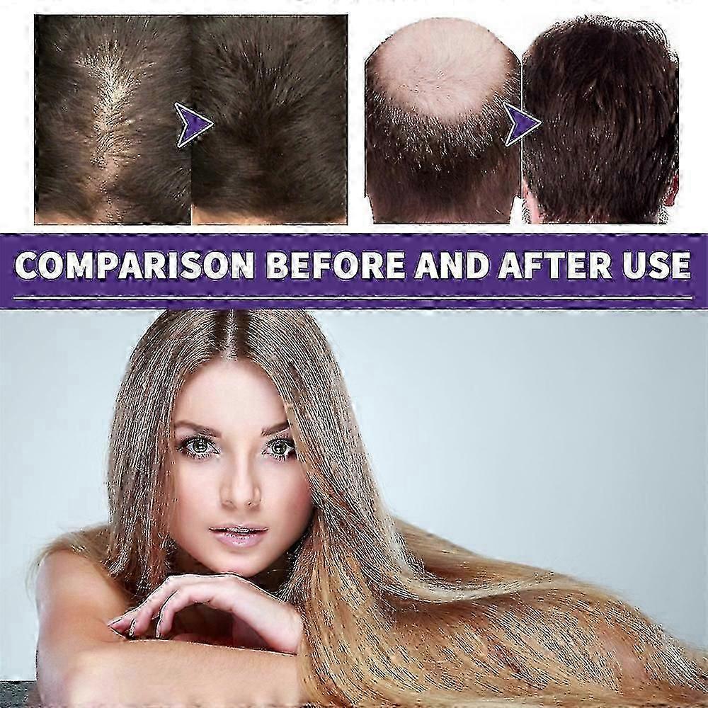 Traitement Pousse des Cheveux Extra Force 2% pour Femmes - Solution Topique au Minoxidil pour Combattre la Chute des Cheveux & Stimuler la Nouvelle Pousse