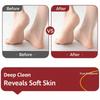 Lima de Pies de Doble Cara para Eliminar Callos Herramienta Profesional de Pedicura para Exfoliación de Piel Muerta y Talones Duros Uso en Casa