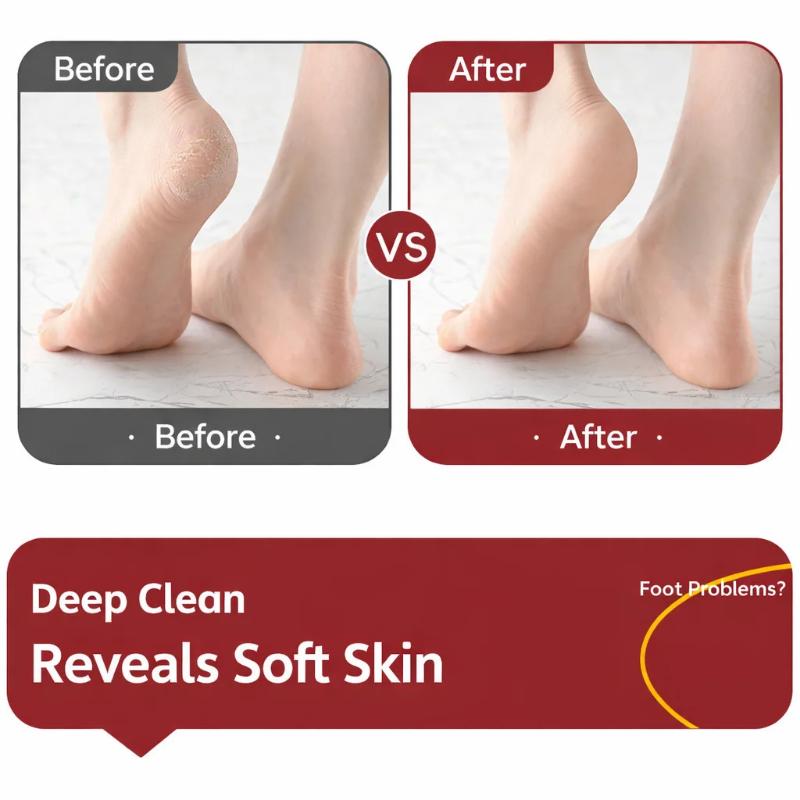 Lima de Pies de Doble Cara para Eliminar Callos Herramienta Profesional de Pedicura para Exfoliación de Piel Muerta y Talones Duros Uso en Casa