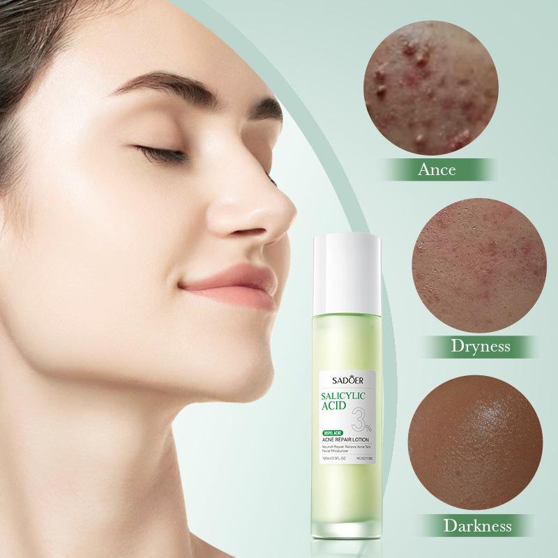 Salicylic Acid Nourishing Essence Milk SADOER Moisturizing Hydrating Refreshing Water Milk