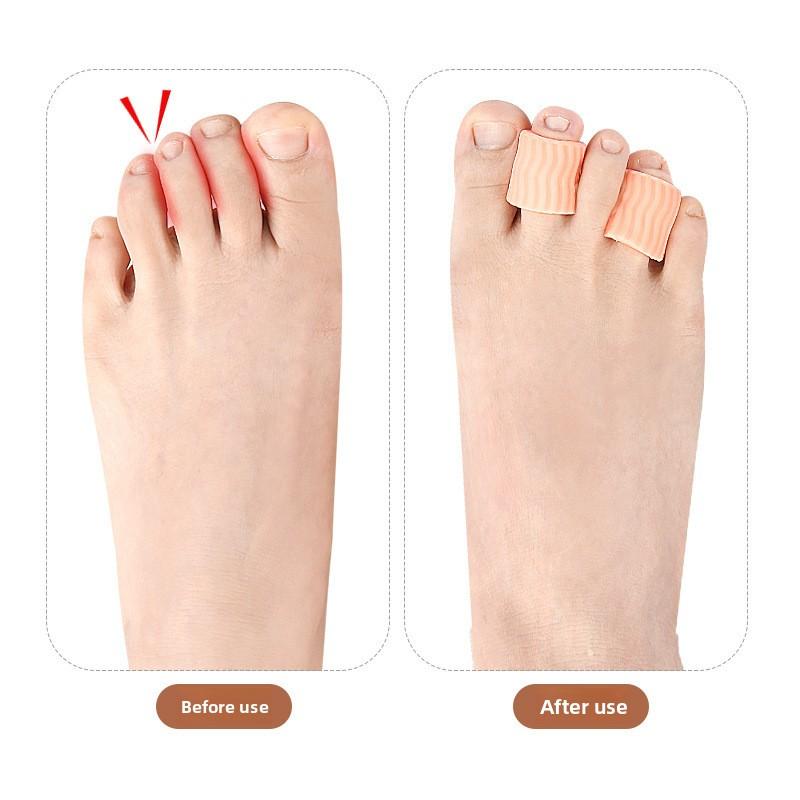 Zehenschutz für kleine Zehen, Hühneraugenabdeckung, High Heels, Weich, Anti-Scheuern, Zehenschutz, Blasenabdeckung, Hühneraugenabdeckung, SEBS-Fingerabdeckung, Kann zugeschnitten werden