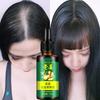 Nourishing Ginger Hair Essence For Healthy And Shiny Locks With Oil Control Benefits