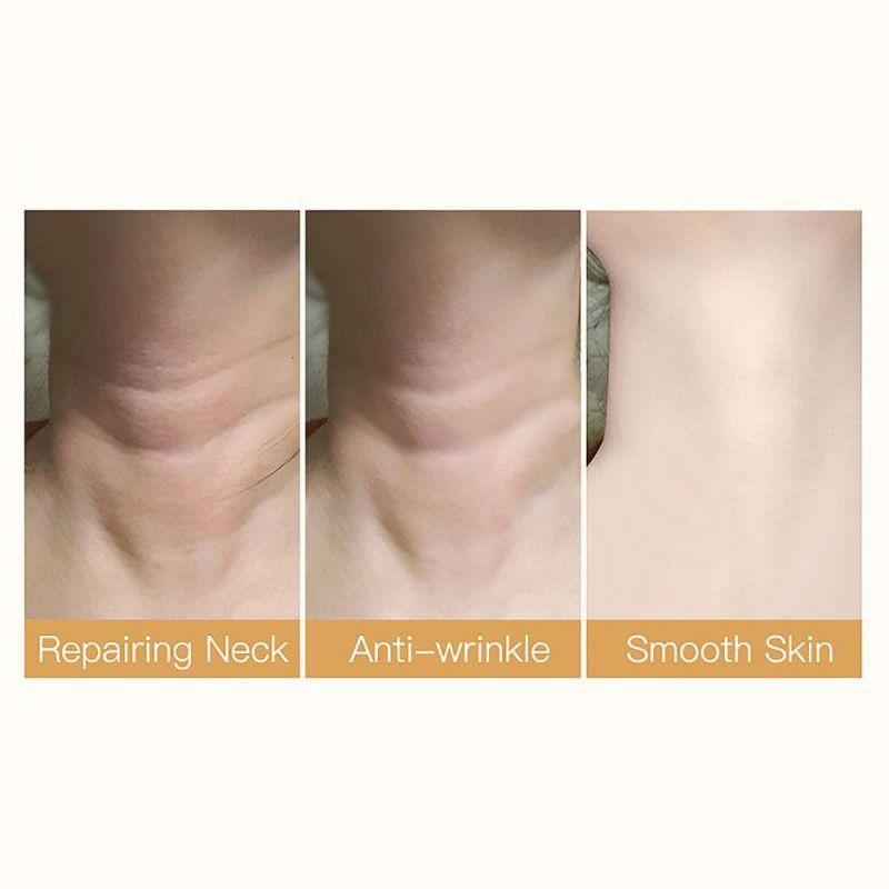 Neck Cream To Lighten Neck Lines, Keep Neck Fair, Anti-aging: Brighten Skin Tone, Moisturize, Firm, Soften Skin