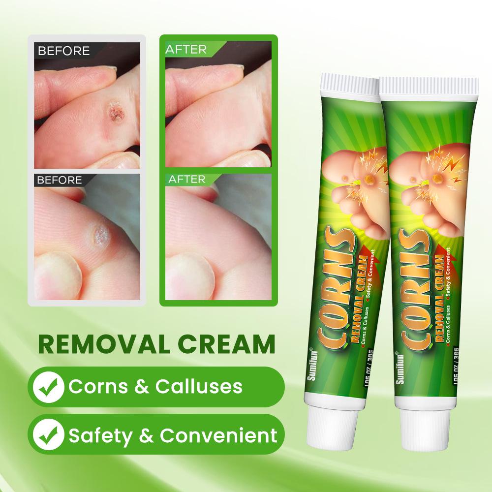 Foot Corn Removal Killer Foot Protection Pain Relief Curative Cream Medical Corns Plaster