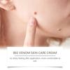 Verruca Care Cream Gentle Cleansing, Moisturizing And Softening The Skin, Reducing Skin Discomfort.