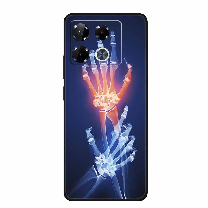For Infinix Note 40 Pro Case Note40 Pro Plus Phone Cover Black Silicone Soft Case For Infinix Note 40 Pro Plus Back Cover Case