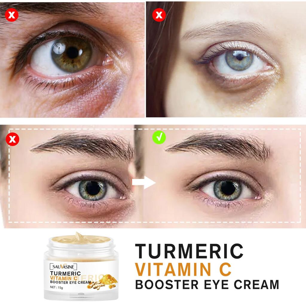 Curcumin VC Eye Cream VC Brightening Eye Cream Moisturizes Fades Fine Lines And Lightens Black Circles Under The Eyes