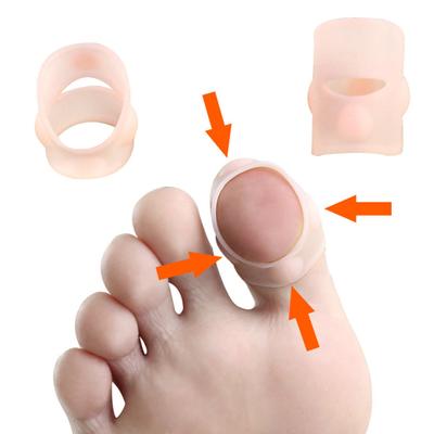 1 paio di dispositivi anti-dita incarnite in gel di silice morbido e moderato, cuscinetti per dita dei piedi durevoli, correttore per unghie per la casa