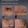 Deeply Cleanse Pores Dirt Facial Cleanser Brighten Face Cream Improve Dark Spots Firming Reduce Dry Fine Lines Essence Skincare