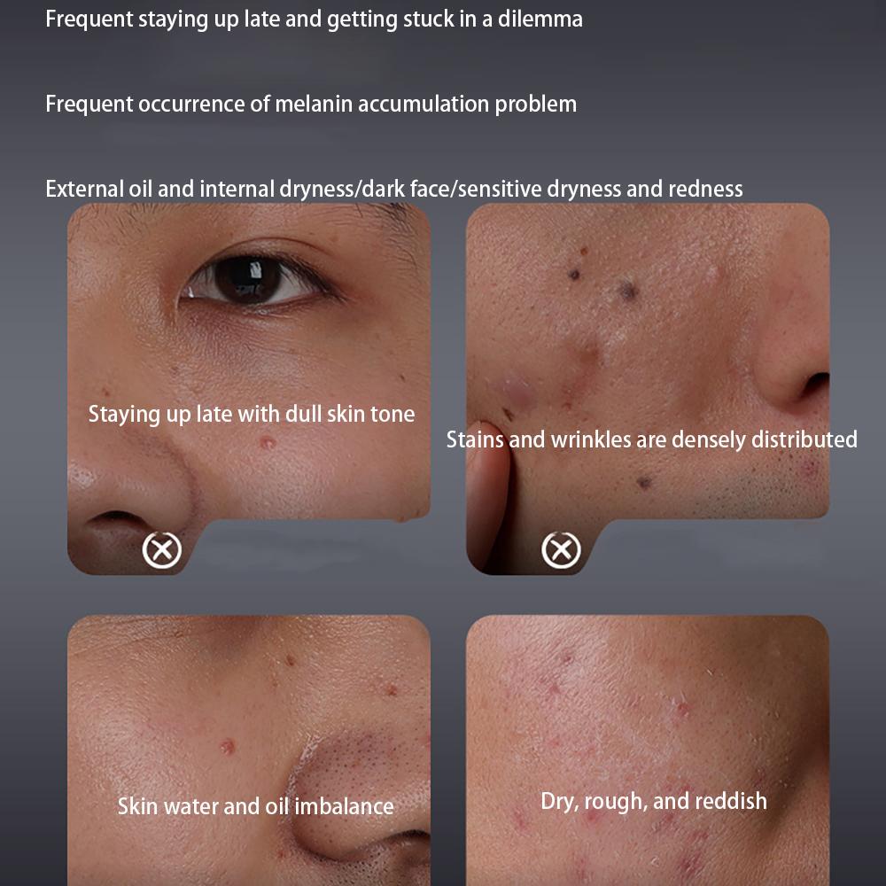 Deeply Cleanse Pores Dirt Facial Cleanser Brighten Face Cream Improve Dark Spots Firming Reduce Dry Fine Lines Essence Skincare