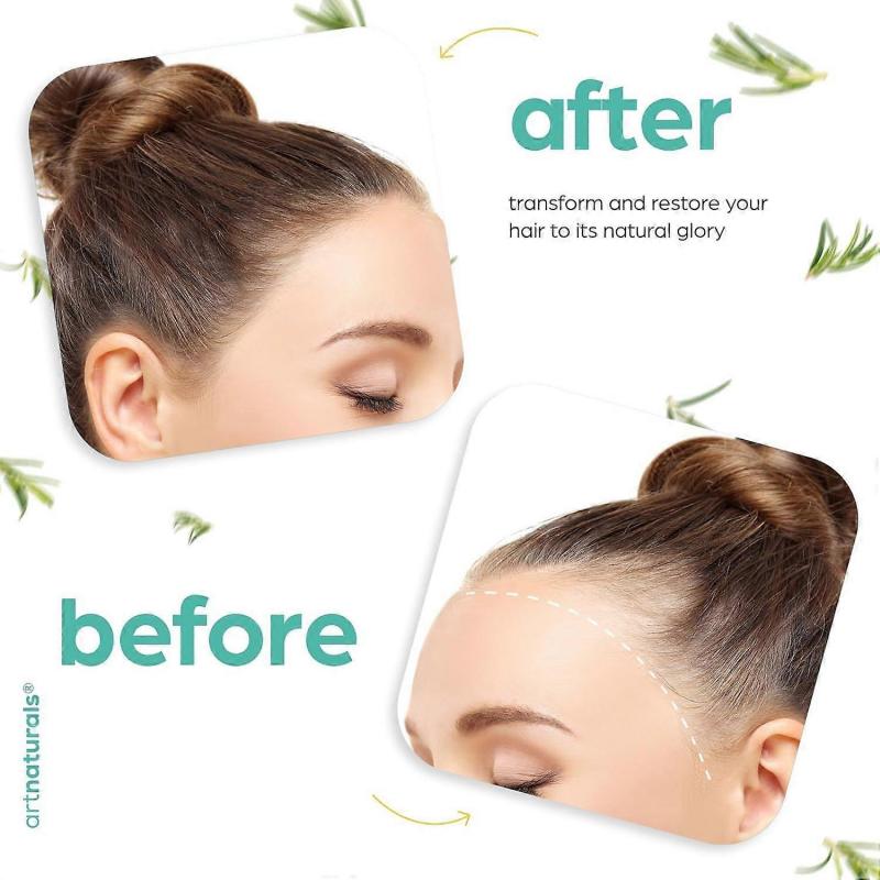 Organic Rosemary & Castor Hair Growth Oil + Scalp Massager Set - Hair Styling Oil for Dry, Itchy Scalp, Thickening & Hydration & Repair For Damaged Ha