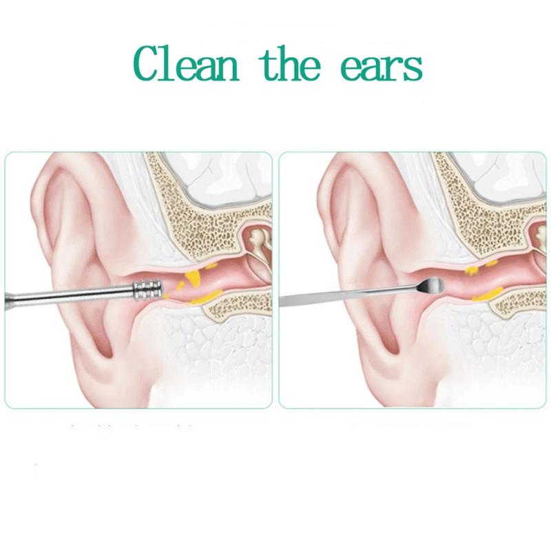Stainless Steel Ear Pick Wax Remover Curette Ear Cleaner Spring Double Head Rotating Ear Scoop Set