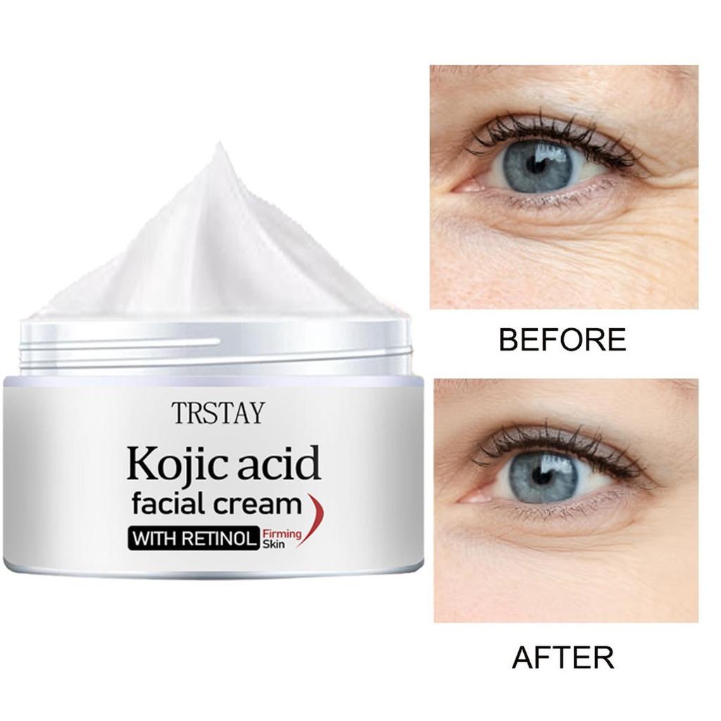 Whitening Eye Cream, Caring for Eye Skin, Moisturizing and Hydrating, Brightening and Firming Eye Skin Care Cream