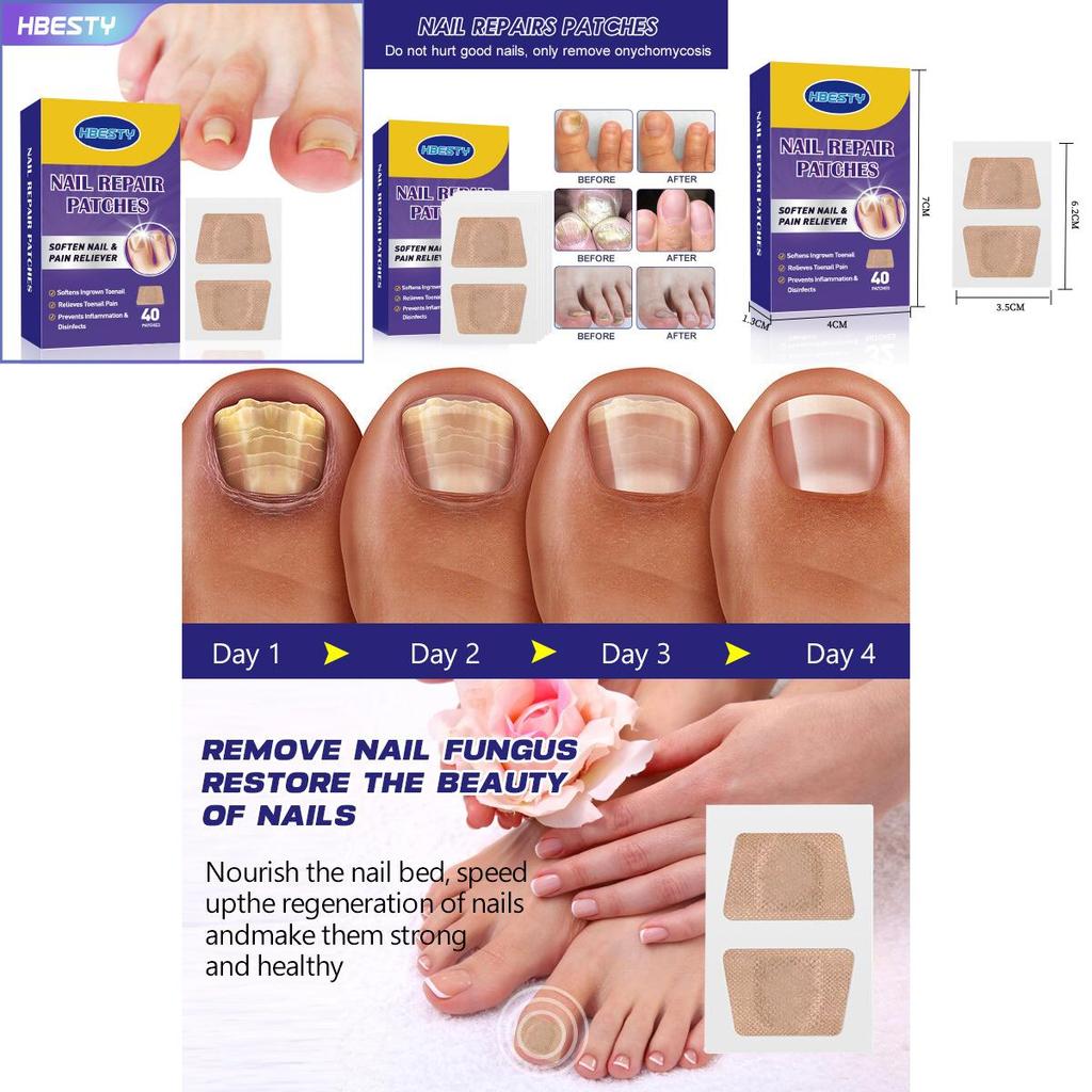 Hbesty Toenail Repair Patches For Damaged Soft Nails With Herbal Scented Comfort 40 Count