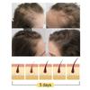 Youdaoplaceholder0 Rice Shampoo Soap Rice Essence Promotes Dense Hair Nourishing And Repairing Shampoo Soap