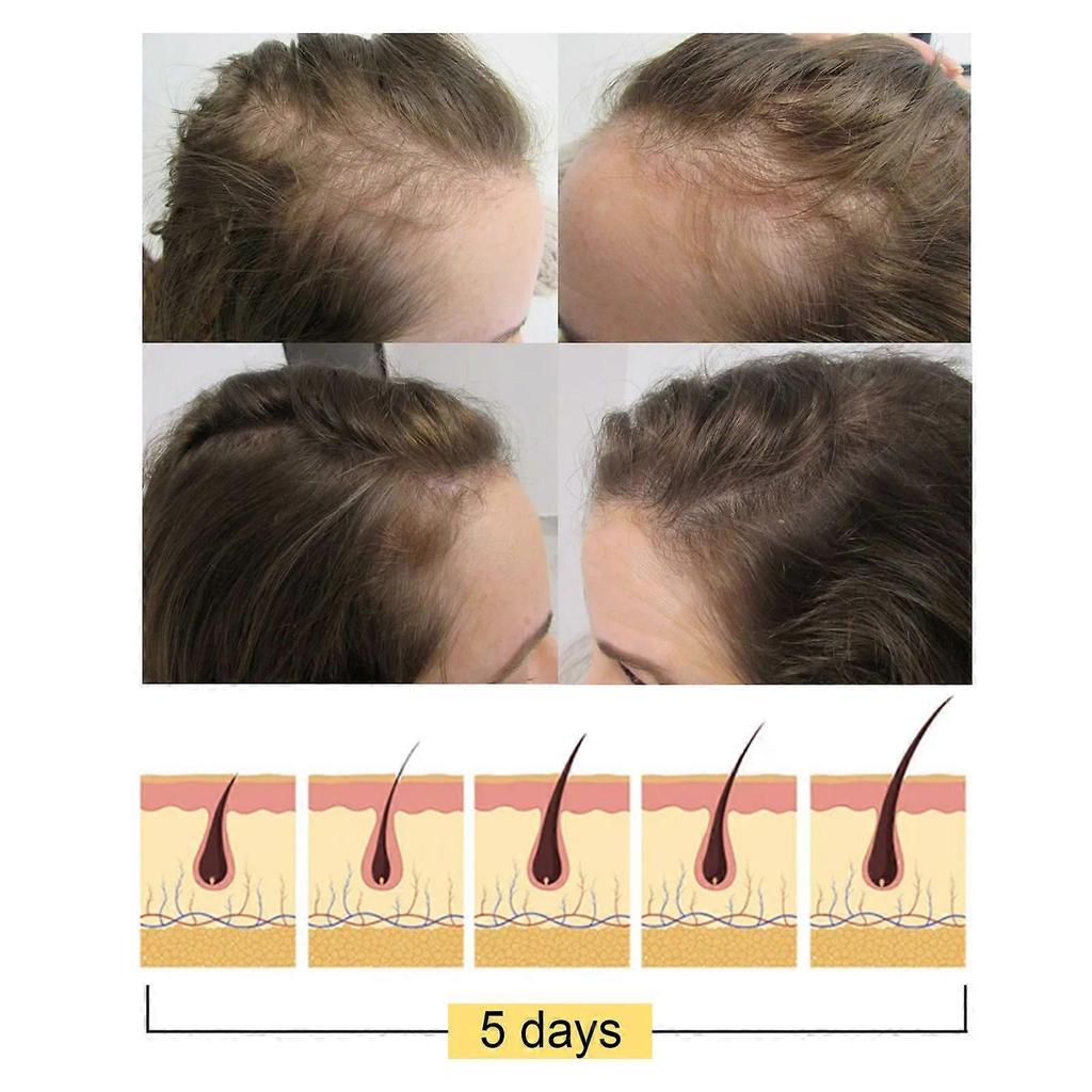 Youdaoplaceholder0 Rice Shampoo Soap Rice Essence Promotes Dense Hair Nourishing And Repairing Shampoo Soap