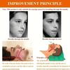 Anti-snoring Band Open Mouth Breathing Corrective Anti-snoring Chin Rest Sleep Open Mouth Rest