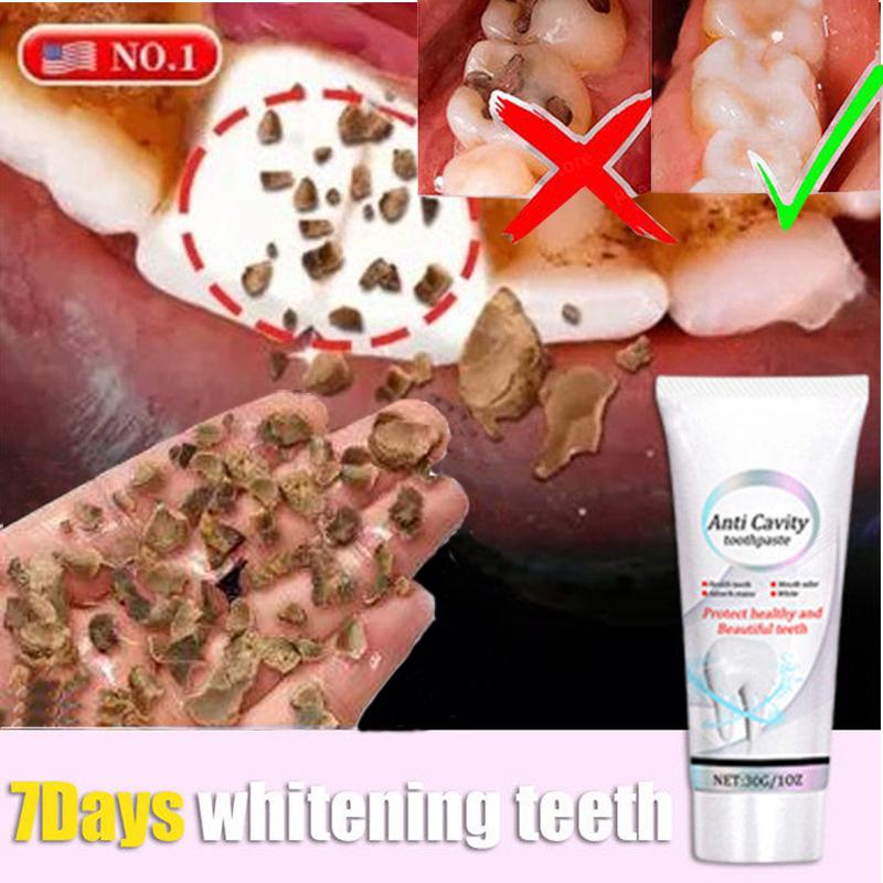 Blanchir les dents réparation dentifrice carie dentaire enlever la Plaque soulager la parodontite mal de dents élimination rafraîchit l'haleine soins des dents