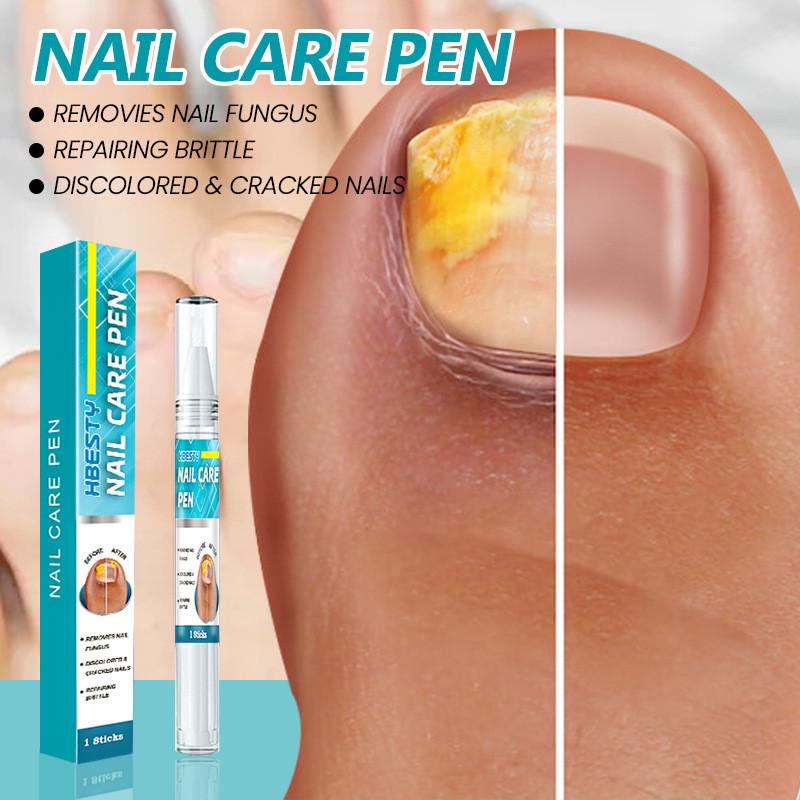 Hbesty Nagelpflege Stift Kräuterduftende Fußbehandlung für gesunde Nägel und Haut