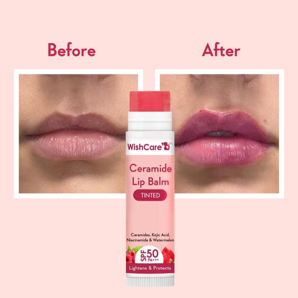 WishCare Tinted Ceramide Lip Balm SPF50 PA+++ with Kojic Acid Niacinamide 5gm Pack of 1 for Lip Lightening