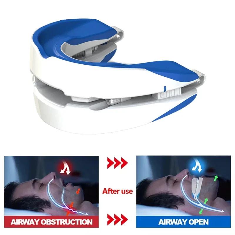 Langlebige Und Sichere Anti-Schnarch-Mundschiene Anti-Schnarch-Gerät Nachts Zähne Mundschutz Einstellbarer Schlaf-Mundschutz Für Bruxismus Schnarchen Stoppen