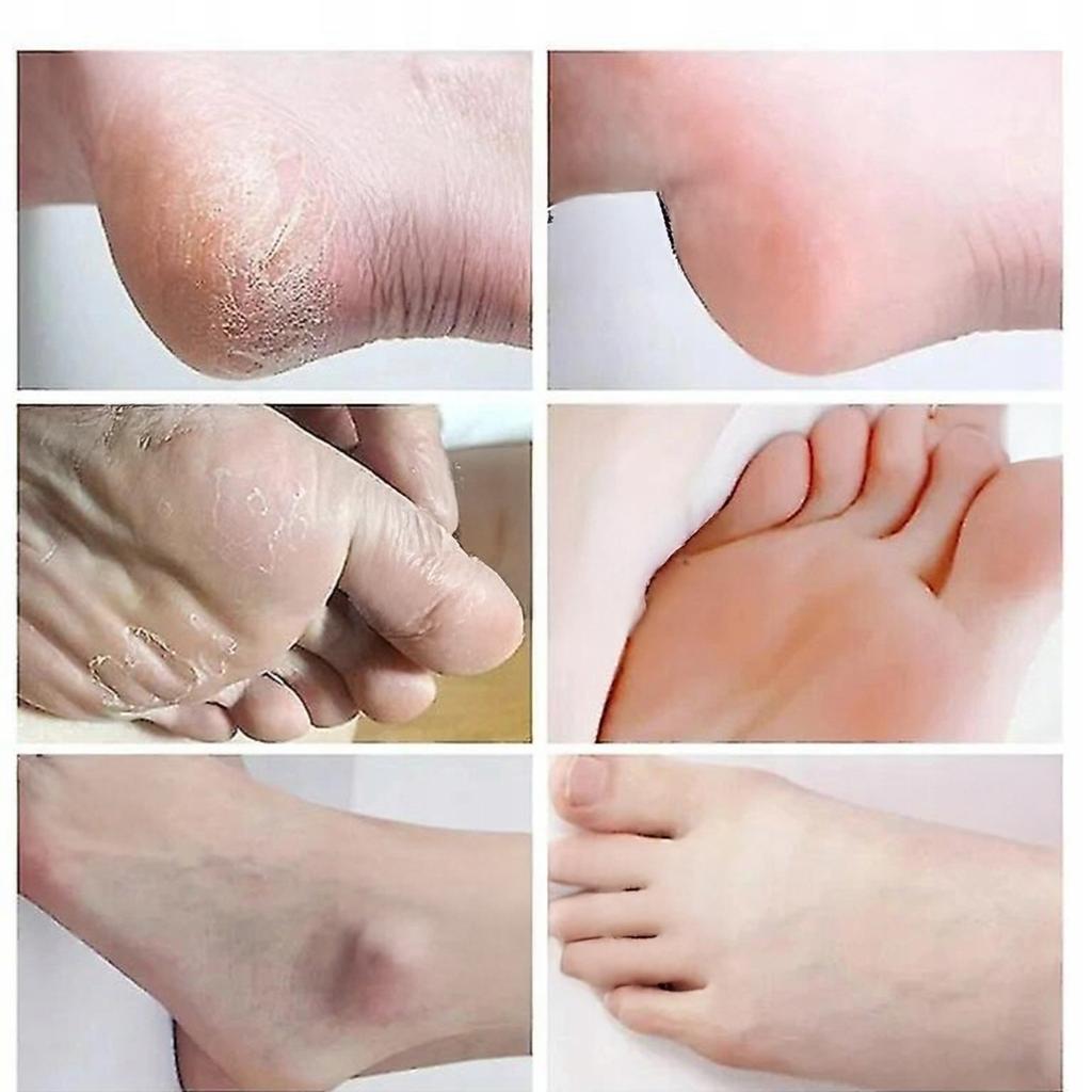 Bioaqua Enzymatic Foot Peeling 180 Ml